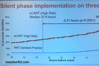 Ecart 10 12